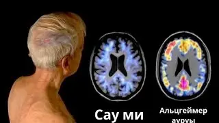 АЛЬЦГЕЙМЕР АУРУЫ БЕЛГІСІ мен ЕМІ / Денсаулыққа пайдалы кеңестер