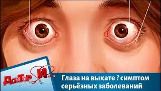 Глаза на выкате – симптом серьёзных заболеваний | Доктор И