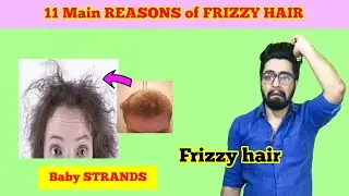7 Main & COMMON Reasons of FRIZZY HAIR & it's Solutions - Part 1 | #menshair #frizzyhair #haircare