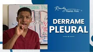 DERRAME PLEURAL: DEFINICIÓN, DIAGNÓSTICO Y TRATAMIENTO
