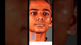 Snapseed Pimples Remove Photo Editing || Snapseed face gora editing 