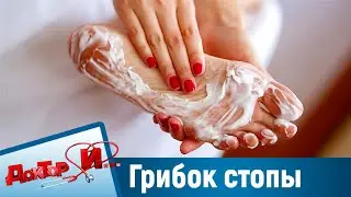 Всё о грибке стопы. “Доктор И“