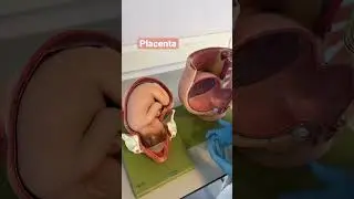 Placenta previa 