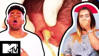 An Amazing Pus Rocket Erupts From A Man’s Massive Neck Boil | What The Yuck?! Ep #2