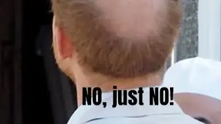 No Harry