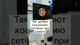 модель лазерного лечения при диабетической ретинопатии 