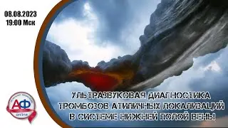 Ультразвуковая диагностика тромбозов атипичных локализаций в системе нижней полой вены
