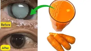 DRINK FOR STRONGER EYESIGHT AND REMOVE CATARACT |How to repair your vision naturally at home