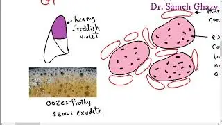 Systemic pathology 13 : respiratory system 1 ( pneumonia and lung abscess) DR.SAMEH GHAZY