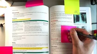How I Remember Everything I Read in Medical School