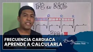 CALCULA TU FRECUENCIA CARDIACA EN EL EKG