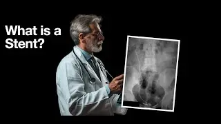 UroPatient Episode 6: What are Ureteral Stents?