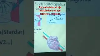 Eje electrico & eje anatomico del corazón, así coinciden 