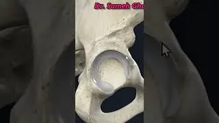 acetabulum of hip bone