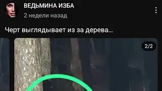 Поняла за что глаз потеряла или духовная революция Инги Хосроевой.