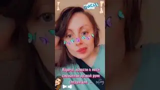НОВОСТИ ПРО СЛОМАННУЮ РУКУ. МНЕ СНЯЛИ ГИПС. ДВЕ НОЧИ БОЛИТ РУКА. ЧТО ДЕЛАТЬ? ВЛОГ. VLOG. 20.21.04.23