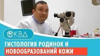 ✔ Гистология родинок и новообразований кожи. Клинический случай №460
