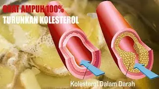 Kolesterol 100% Turun, Sakit Pinggang Dan Rematik Sembuh Total