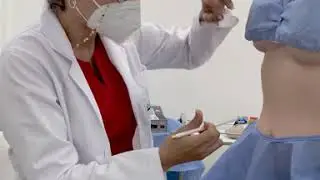 Protocolo de corrección de cicatrices