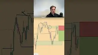 TP or SL hit? EURUSD Trade Breakdown