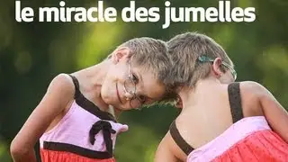 le miracle des jumelles : body bizarre