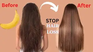 HOW TO STOP HAIR LOSS FAST| 💯 NATURAL REMEDY