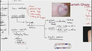 Systemic pathology 4 : CVS (infective and non-infective endocarditis) DR.SAMEH GHAZY