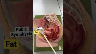 Female pelvis ❤️ 