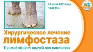 Хирургическое лечение лимфостаза