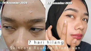 Skincare Routine untuk kulit kering bruntusan