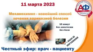 Механохимическая облитерация - современный метод лечения варикозной болезни