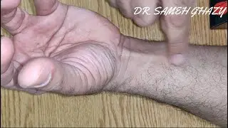 ازاى تعرف عندك العضلة دى ولا لا !!