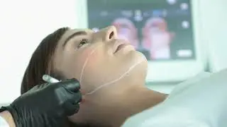Ultherapy Boyun Gençleştirme