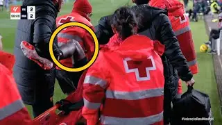 Doctor Reacts to Mouctar Diakhaby Horrible Knee Injury and Replay
